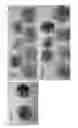 Fig. 07 - ORAL CARE METHODS AND COMPOSITIONS UTILIZING CHITOSAN-DERIVATIVE COMPOUNDS