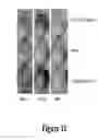 Fig. 12 - ORAL CARE METHODS AND COMPOSITIONS UTILIZING CHITOSAN-DERIVATIVE COMPOUNDS