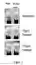 Fig. 13 - ORAL CARE METHODS AND COMPOSITIONS UTILIZING CHITOSAN-DERIVATIVE COMPOUNDS