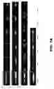 Fig. 15 - Hydrogel microparticle scaffold with gradients of degradability and methods thereof