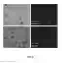 Fig. 04 - HIF-2-ALPHA INHIBITOR POLYMORPHS