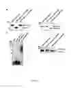 Fig. 07 - Acinetobacter O-oligosaccharyltransferases and uses thereof