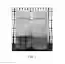 Fig. 02 - NEUROSTEROID COMPOSITIONS AND METHODS OF USE THEREOF