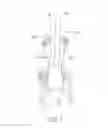 Fig. 02 - HEMODIALYSIS DEVICE