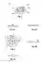 Fig. 02 - External catheter stabilizer