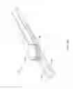 Fig. 07 - Access sheath with integrated closure device