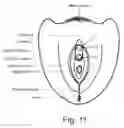 Fig. 10 - Non-invasive device and method for stimulating vulvar tissues and pelvic floor muscles for treating and improving dysfunction or disorders and probe unit used therefor