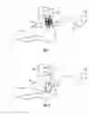 Fig. 02 - METHODS AND DEVICES FOR TREATING MIGRAINES WITH ELECTROMAGNETIC STIMULATION