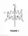Fig. 02 - DEVICE FOR SELECTIVE MODIFICATION/DESTRUCTION OF ORGANIC TISSUE