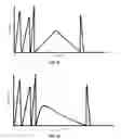 Fig. 06 - METHOD AND APPARATUS FOR PLYOMETRIC FORCE APPLICATION TO MUSCLE