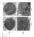 Fig. 12 - METHODS OF PREVENTING AND REVERSING STEM CELL AGING