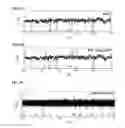 Fig. 07 - DETECTION OF NUCLEIC ACID POLYMERASE CONFORMATIONAL CHANGES USING A NANOTUBE