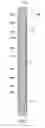 Fig. 06 - Determining core sample volume within a sealed pressure vessel