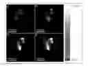 Fig. 01 - Methods for second harmonic generation imaging of protein crystals