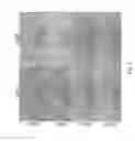 Fig. 09 - Engineering of a novel breast tumor microenvironment on a microfluidic chip