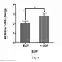 Fig. 12 - Engineering of a novel breast tumor microenvironment on a microfluidic chip