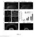 Fig. 15 - Engineering of a novel breast tumor microenvironment on a microfluidic chip