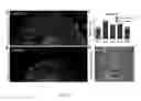 Fig. 16 - Engineering of a novel breast tumor microenvironment on a microfluidic chip