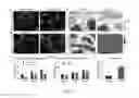 Fig. 17 - Engineering of a novel breast tumor microenvironment on a microfluidic chip