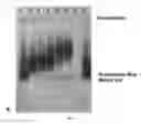 Fig. 07 - Catalytic particles for increased sensitivity in lateral flow immunoassays