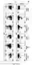 Fig. 19 - Methods for diagnosing hematological cancers