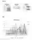 Fig. 06 - DATA PROCESSING METHOD OF PERSONAL RADIATION DOSIMETER TO RECOGNIZE ACTIVITY OF WEARER BY USING MOTION SENSOR VALUE