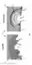 Fig. 09 - Camera lens suspension with enhanced auto focus electrical interconnects