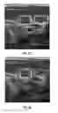 Fig. 07 - Method and system of computer-aided detection using multiple images from different views of a region of interest to improve detection accuracy