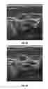 Fig. 08 - Method and system of computer-aided detection using multiple images from different views of a region of interest to improve detection accuracy