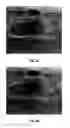 Fig. 09 - Method and system of computer-aided detection using multiple images from different views of a region of interest to improve detection accuracy