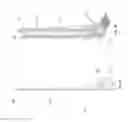 Fig. 02 - Electrically controlled movable tree stand for supporting a person