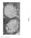 Fig. 02 - COMPOSITIONS AND METHODS OF PRESERVING MEAT SUBSTITUTES