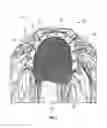 Fig. 02 - MULTI-COMPONENT HAIRPIECE