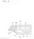 Fig. 10 - Button back and button