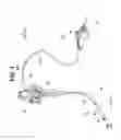 Fig. 02 - ENDOSCOPE AND OPTICAL TRANSMISSION MODULE