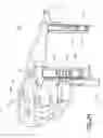 Fig. 03 - Binocular viewing assembly for a surgical visualization system
