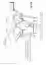 Fig. 29 - Binocular viewing assembly for a surgical visualization system
