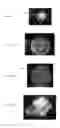 Fig. 04 - METHOD FOR DETECTING FLUID INJECTION IN A PATIENT