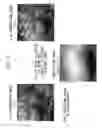 Fig. 08 - IMAGE PROCESSING APPARATUS AND ENDOSCOPE APPARATUS