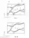 Fig. 07 - Biological information acquisition device and biological information acquisition method