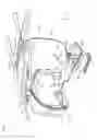 Fig. 02 - Medical device