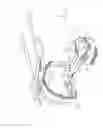 Fig. 06 - Medical device