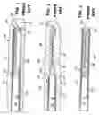 Fig. 02 - Biopsy Method and Apparatus