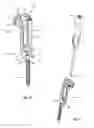 Fig. 09 - Minimally disruptive retractor and associated methods for spinal surgery