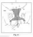 Fig. 49 - Tissue anchor