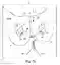 Fig. 71 - Tissue anchor