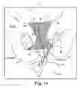 Fig. 72 - Tissue anchor