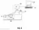 Fig. 07 - Introducing trocar with cryo-fixation of access cannula