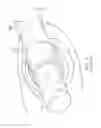 Fig. 02 - Catheter with split electrode sleeve and related methods