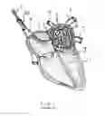 Fig. 02 - Apparatus and method for intra-cardiac mapping and ablation
